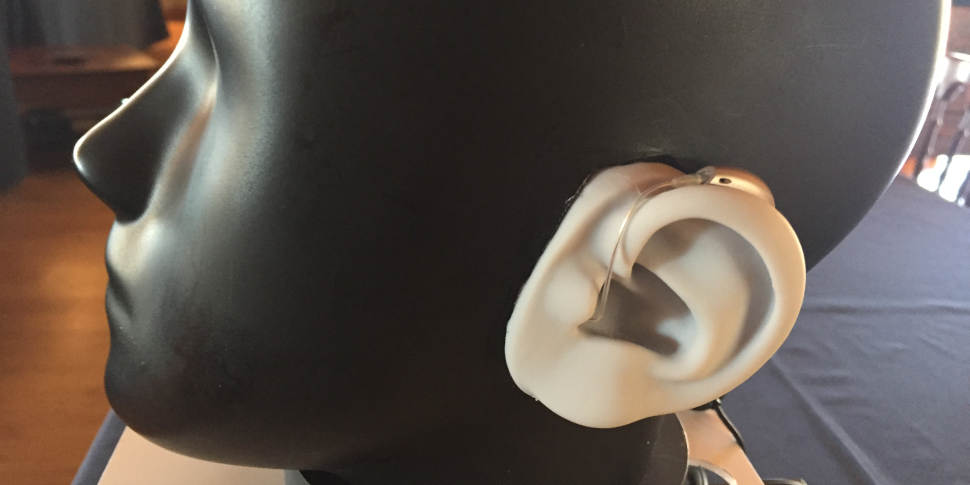 Adaptaci&oacute;n Aud&iacute;fonos